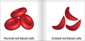 bmtdisorder