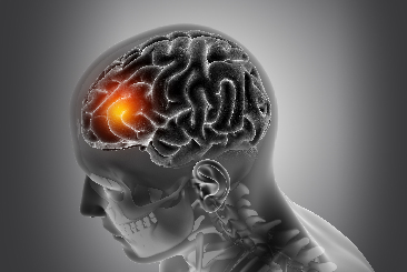 Brain tumour-warning symptoms