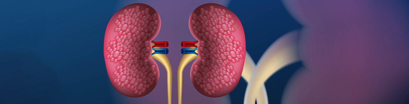 Have a kidney disease? These foods can benefit you