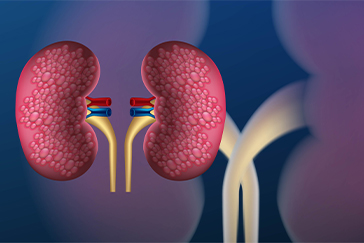 Have a kidney disease? These foods can benefit you
