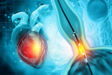 Coronary angiography: Purpose, Procedure and Recovery