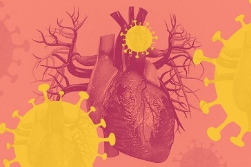 Cardiac patients & risk of COVID severity