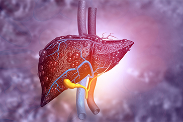 Liver cirrhosis: What it means and how it affects you