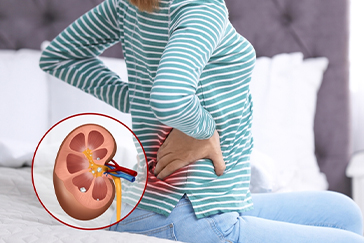 Home remedies that can help you get rid of kidney stones naturally
